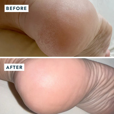 SoleMate Heel Repair Balm